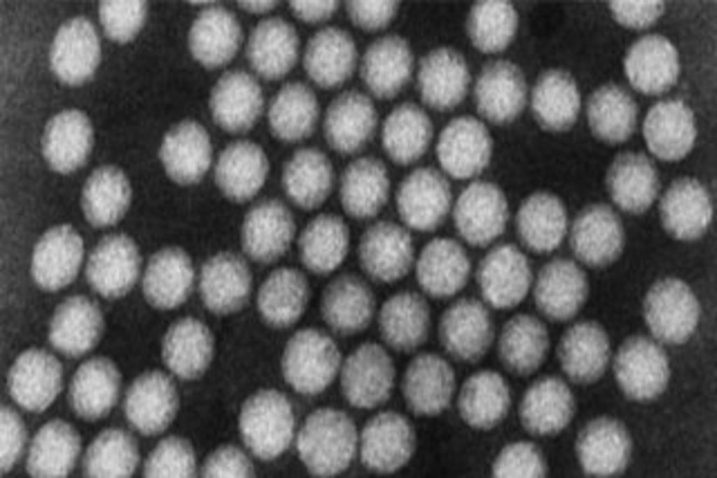 Polioviren, Link auf Polioviren im Kölner Abwasser - Stadt Köln