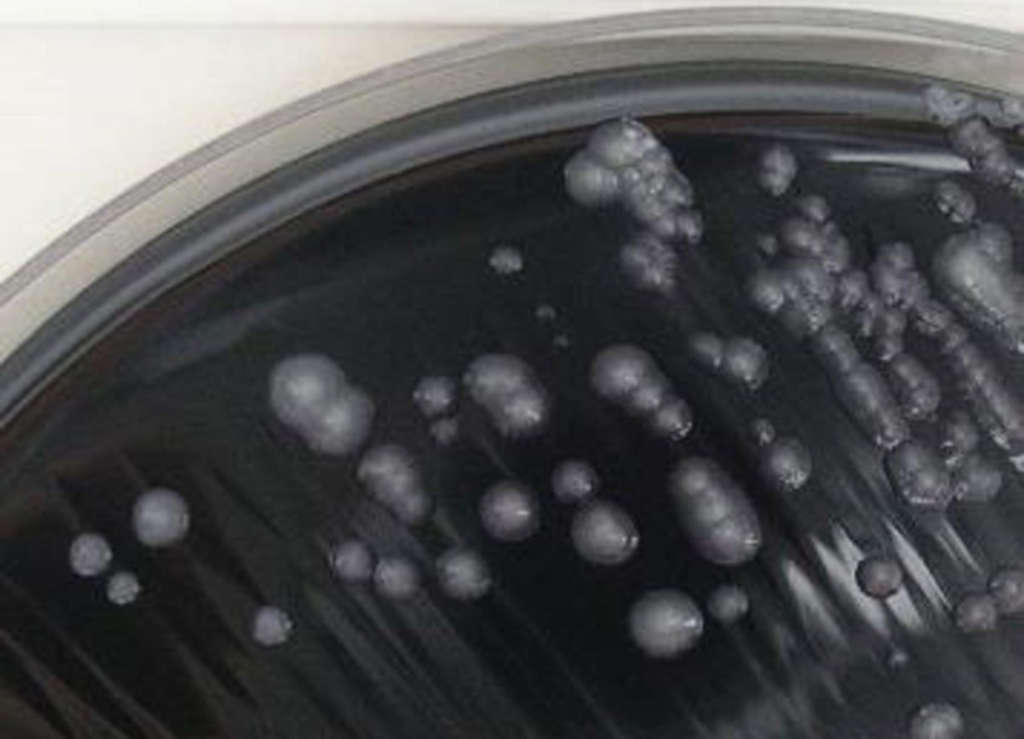 Züchtung einer Legionellen-Kultur in einem Labor des Landesumweltamtes